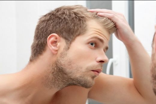 Erkeklerde Saç Dökülmesine Ne İyi Gelir
