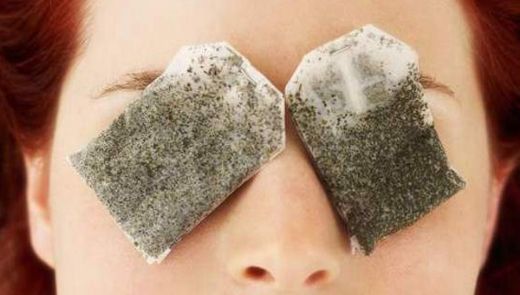 Göz İltihabına Ne İyi Gelir?