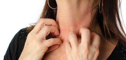 İsiliğe Ne İyi Gelir?